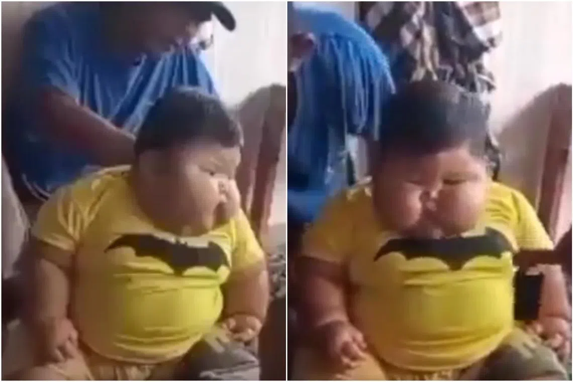 Muhammad Kenzi Alfaro, 16 months, currently weighs 27kg - the same weight as an eight-year-old.