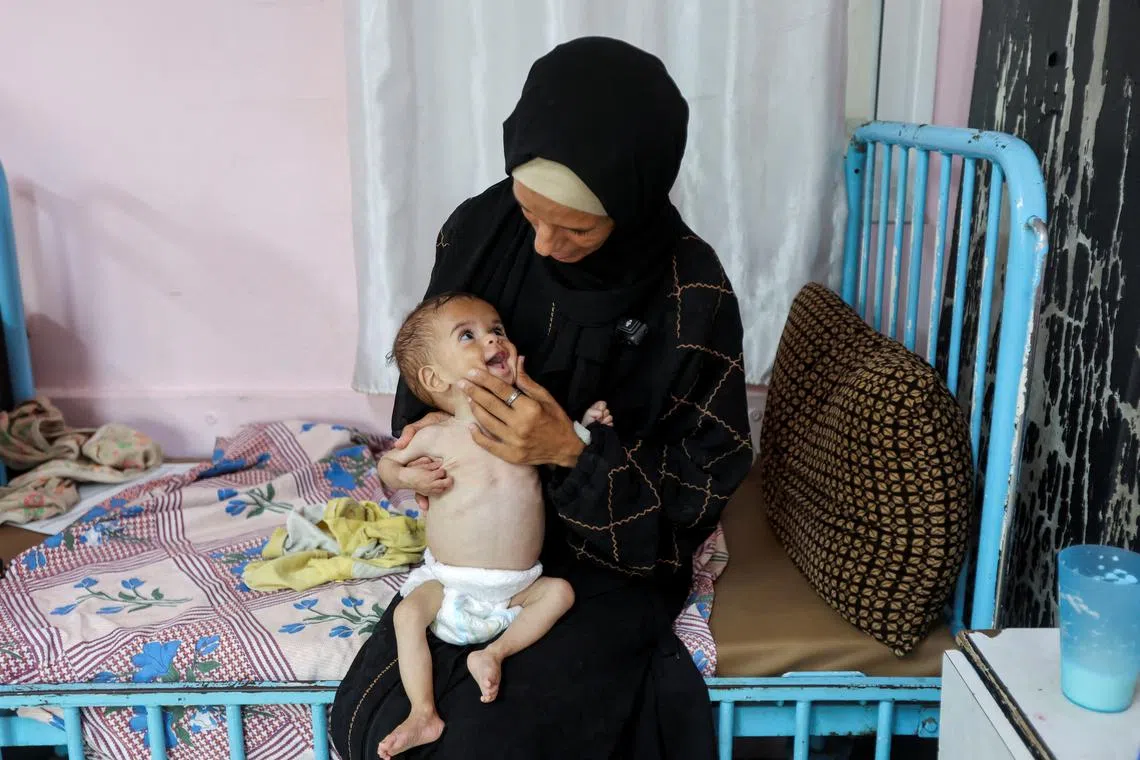 Seela Barbakh, an 11-month-old malnourished Palestinian girl, is held by her mother, Najah, at Nasser Hospital in Khan Younis, in the southern Gaza Strip, July 23, 2025. 