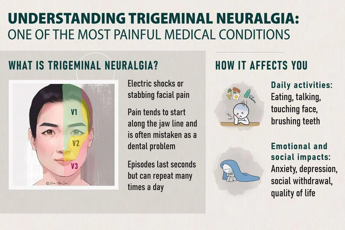 infographic showing symptoms of trigeminal neuralgia