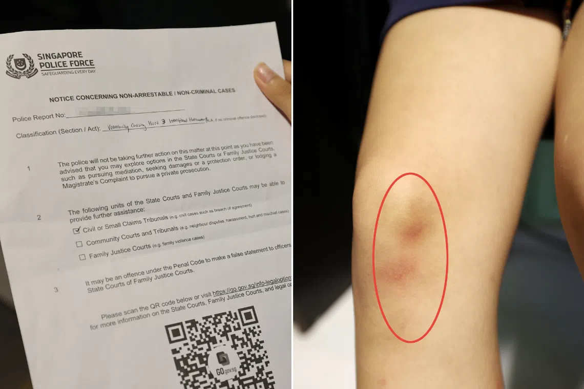 The girl suffered a nose bleed, swollen lips and bruises on her leg. 