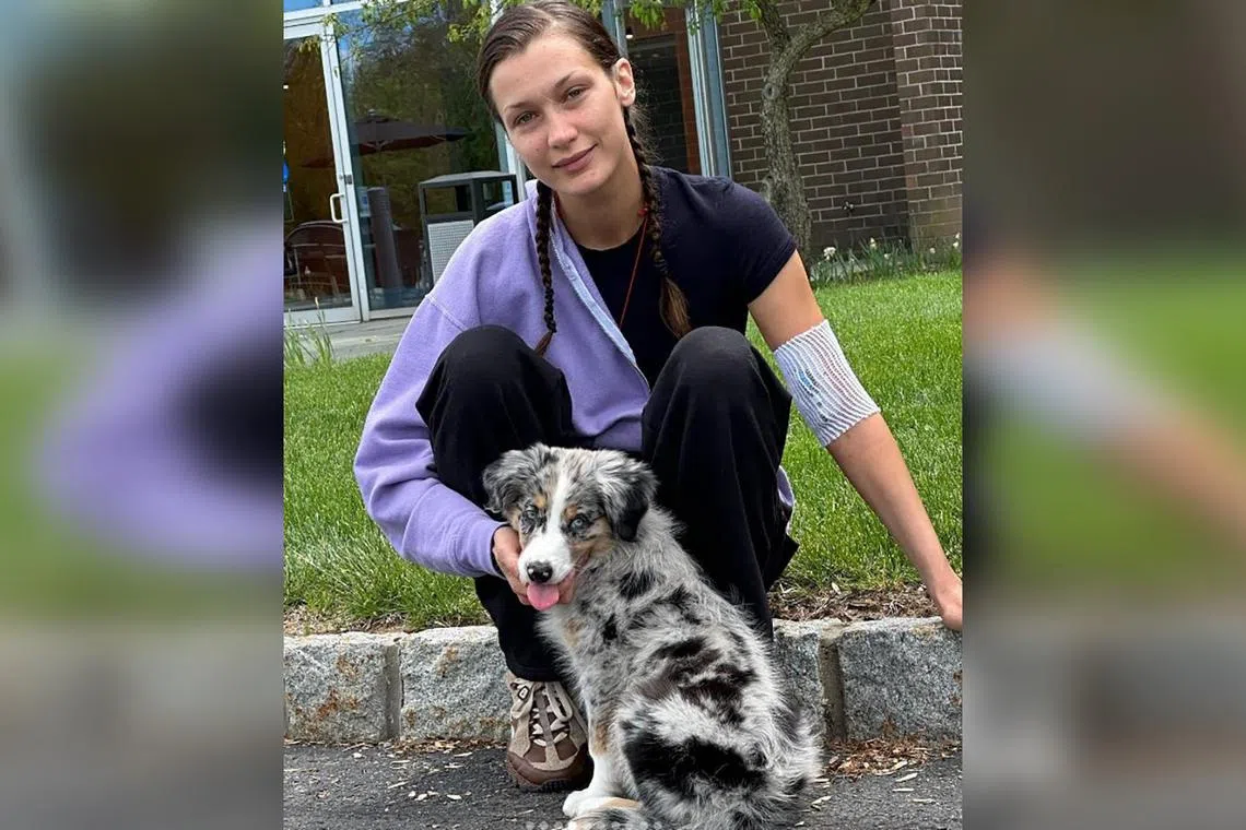 American model Bella Hadid opened up about her lengthy battle with Lyme disease.