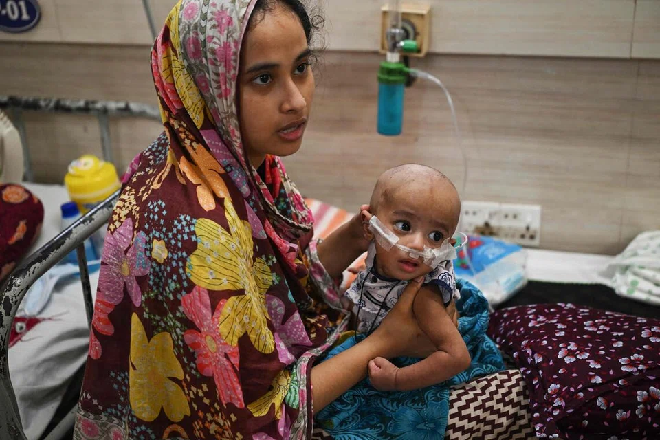 பல ஆண்டுகளில் காணப்படாத அளவு பங்ளாதேஷில் தட்டம்மைத் தொற்று பரவிவருகிறது.