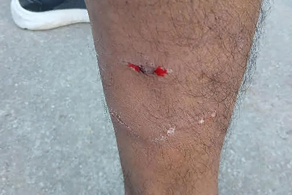 சிலேத்தார் வெஸ்டில் நாய்கள் பாதுகாப்பாகப் பிடிக்கப்பட்டன: ஆல்வின் டான்