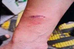 காவல் அதிகாரியின் கையில் காயம் ஏற்பட்டது.