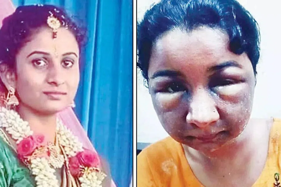 இப்படி இருந்த பெண்ணின் முகம், இப்படியாகிப் போனது. படங்கள்: இந்திய ஊடகம்