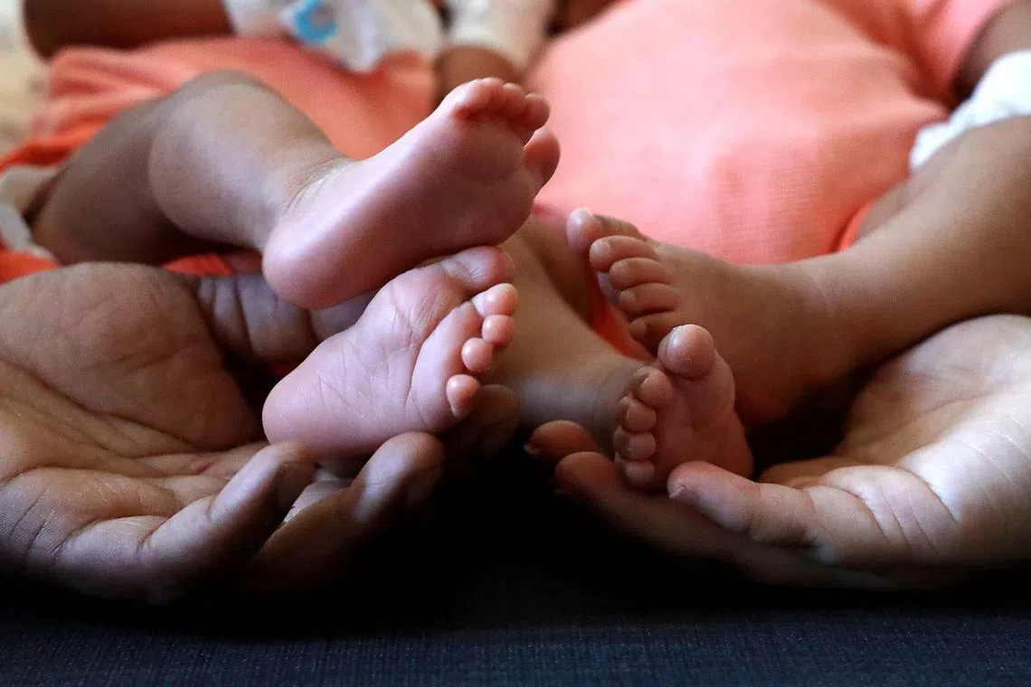 பிறந்த குழந்தைகளிடம் பரிசோதனை