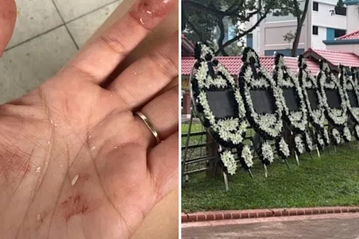 எல்இடி அஞ்சலிப் பலகை விழுந்து மாது காயம்