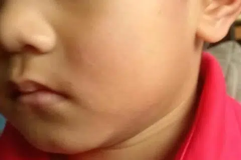 விளையாடிக்கொண்டிருந்தபோது, நடு விரலைக் காட்டிய பிறகு, அந்தச் சிறுவன் அறையப்பட்டதாகக் கூறப்படுகிறது. 