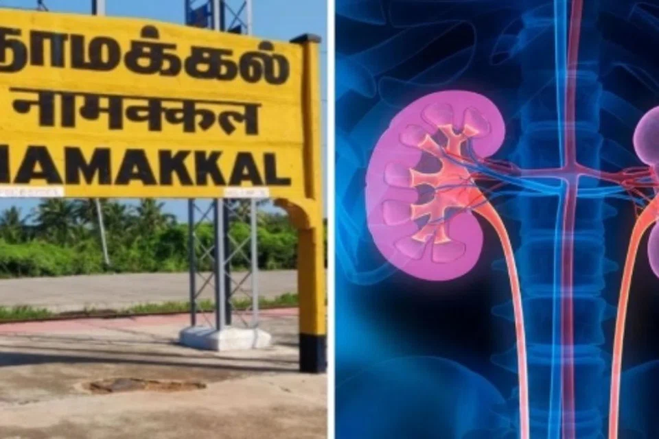நாமக்கல் மாவட்டத்தில் அப்பாவி தொழிலாளர்கள் பலர் சிறுநீரகங்களை விற்றுள்ளனர்.
