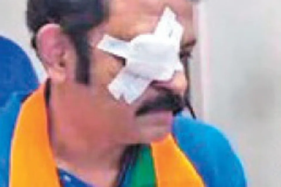 கொல்லம் தொகுதியில் கூர்மையான ஆயுதங்களால் தாக்கப்பட்ட  பாஜ வேட்பாளரும், நடிகருமான கிருஷ்ணகுமார். 