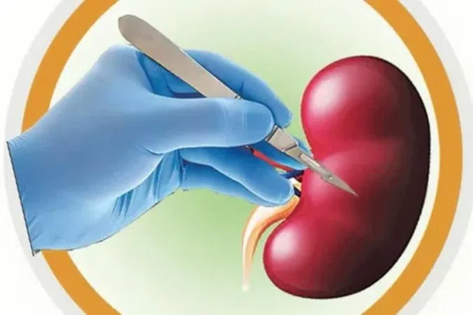 சிறுநீரக முறைகேடு வழக்கு விசாரணை தீவிரம்: அரசு உத்தரவு
