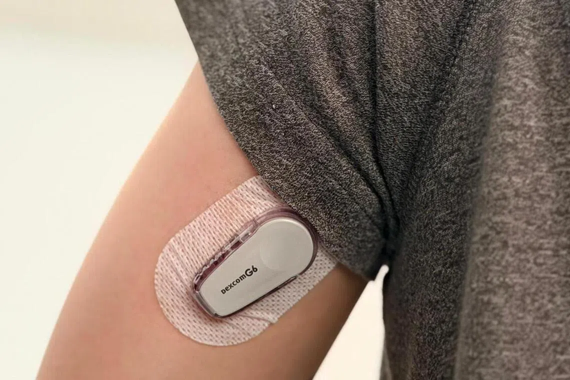 நீரிழிவு கண்காணிப்புச் சாதனம் வாங்க கூடுதல் நோயாளிகளுக்கு 80% வரை உதவி