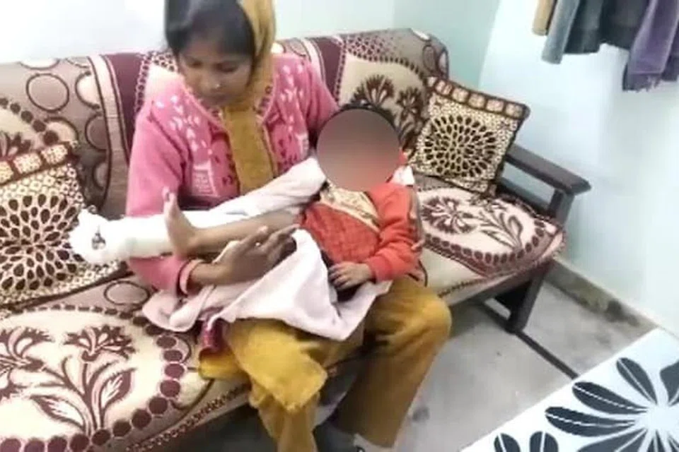கால் முழுக்க கட்டுப்போடப்பட்டுள்ள நிலையில் குழந்தை.