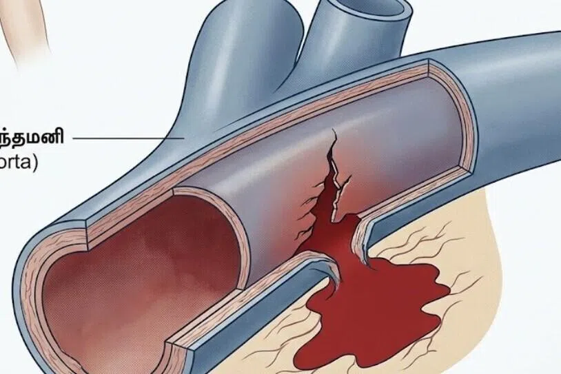தனியார் மருத்துவமனை கைவிட்டபோதும் இறுதியில் பிழைத்த இளையர்