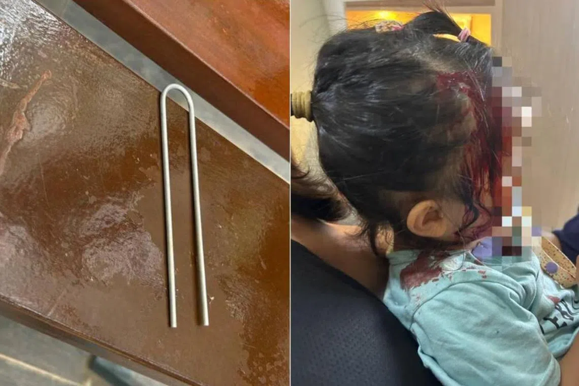 குழந்தை தலையில் உலோகக் கம்பி விழுந்து காயம்