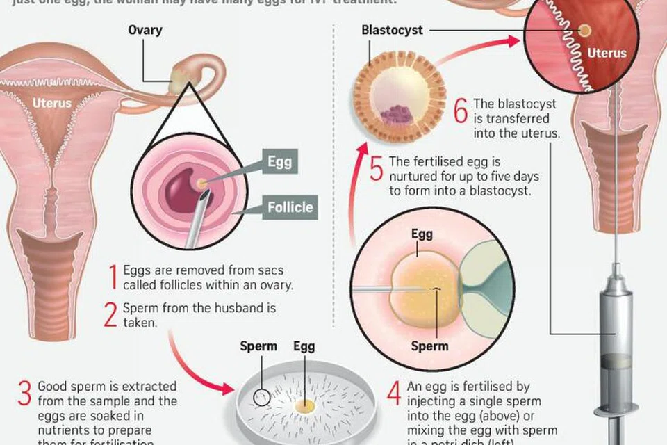 செயற்கைக் கருத்தரிப்பு செய்யும் முறை