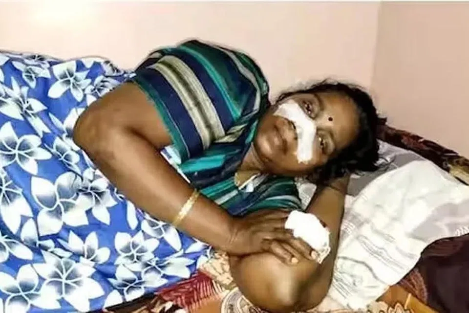 குடும்ப தகராறு காரணமாக துக்க வீட்டிற்குச் சென்றிருந்த மனைவியின் மூக்கை அறுத்த கணவன்.