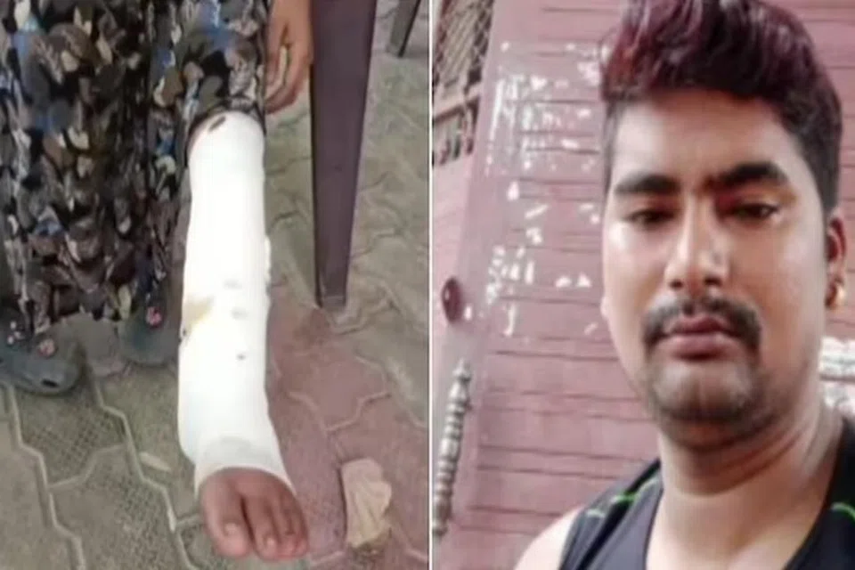 அன்ஷிகா காலில் பாம்பு கடித்த காயம், (வலது) விசாரிக்கப்படும் அனுஜ் பால்.