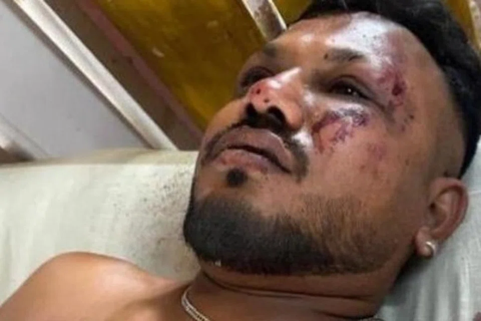 உயிர் பிழைத்த ரமே‌ஷ் விஸ்வா‌ஷ்குமார்.