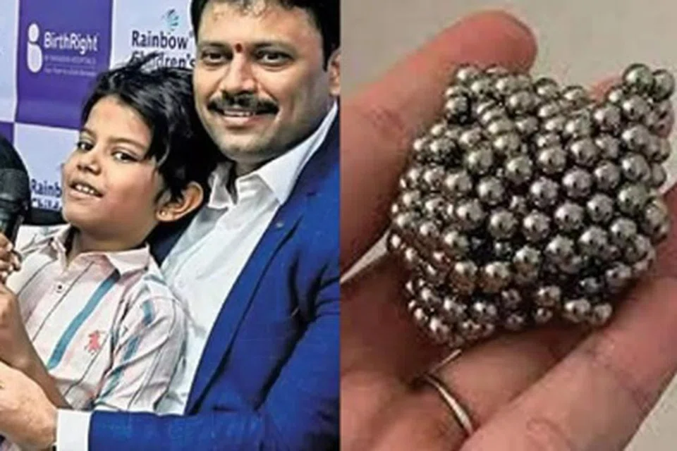 சிறுவனின் வயிற்றில் இருந்த காந்த உருண்டைகள். தந்தையுடன் சிறுவன்.