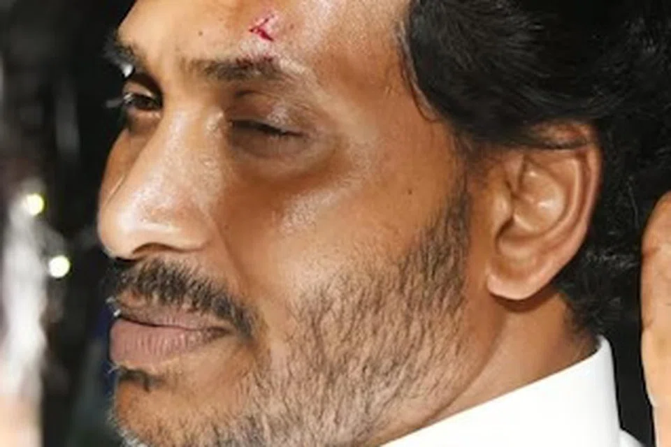 ஆந்திர முதல்வர் ஜெகன்மீது நடத்தப்பட்ட தாக்குதலுக்குப் பின்னணியில் தெலுங்கு தேசம் கட்சி நிர்வாகிகள் இருப்பதாக குற்றச்சாட்டு எழுந்துள்ளது.