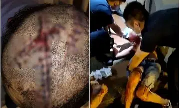 Man jailed for joining 2 friends to attack stranger near Clarke Quay