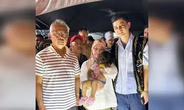 Malaysian Queen offers to adopt two-year-old girl with werewolf syndrome, no nostrils