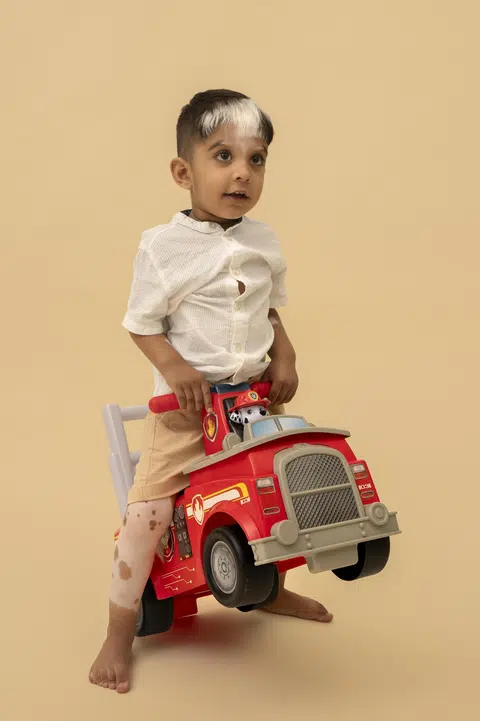 Mohamed Zain, three, who was born with piebaldism, has many friends at Masjid Kampung Siglap Kindergarten.