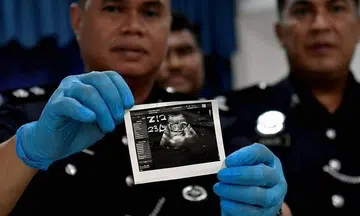 Malaysian man, 20, arrested after allegedly slashing open pregnant lover's belly, burning her twice