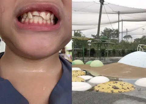 Boy breaks two front teeth after accident at Bird Paradise playground