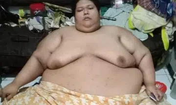 300kg Indonesian man, who was forklifted to hospital, dies