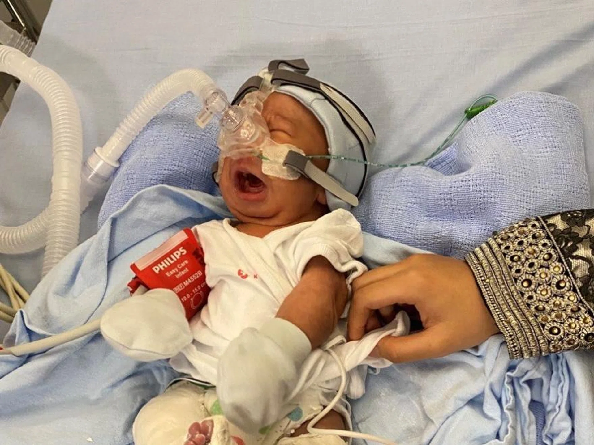 A month after he was born at Thomson Medical Centre, Nurfattah Bin Nurfahmy was diagnosed with a rare disease known as Arthrogryposis Multiplex Congenita (AMC).