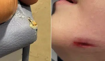 Boy, 4, needs stitches after fall in restaurant playroom