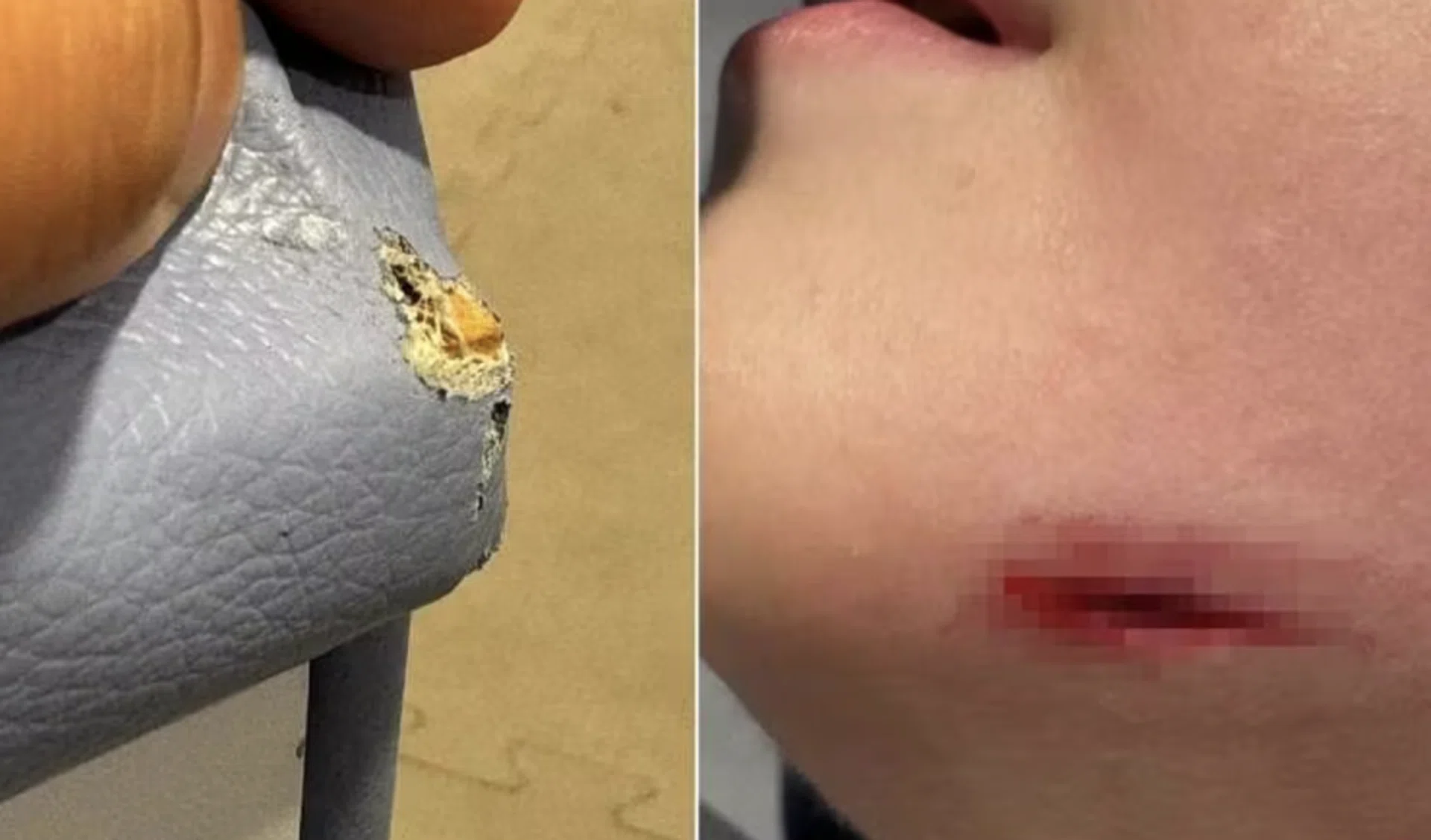 The boy's chin hit the exposed wooden board of the seat.