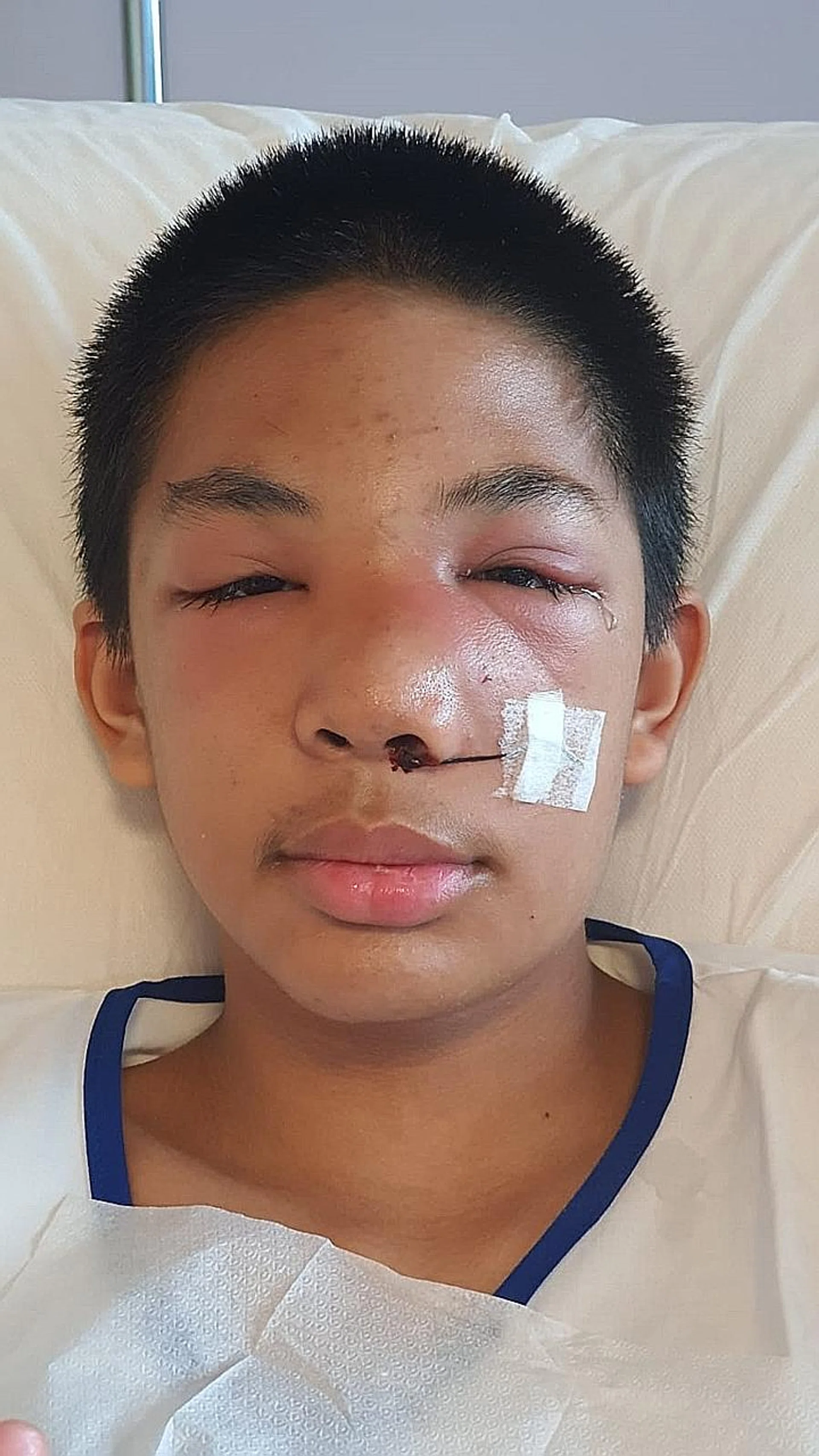 Noridayu Zainuddin's son Imann was allegedly slapped in the face with a slipper. PHOTO: COURTESY OF NORIDAYU ZAINUDDIN