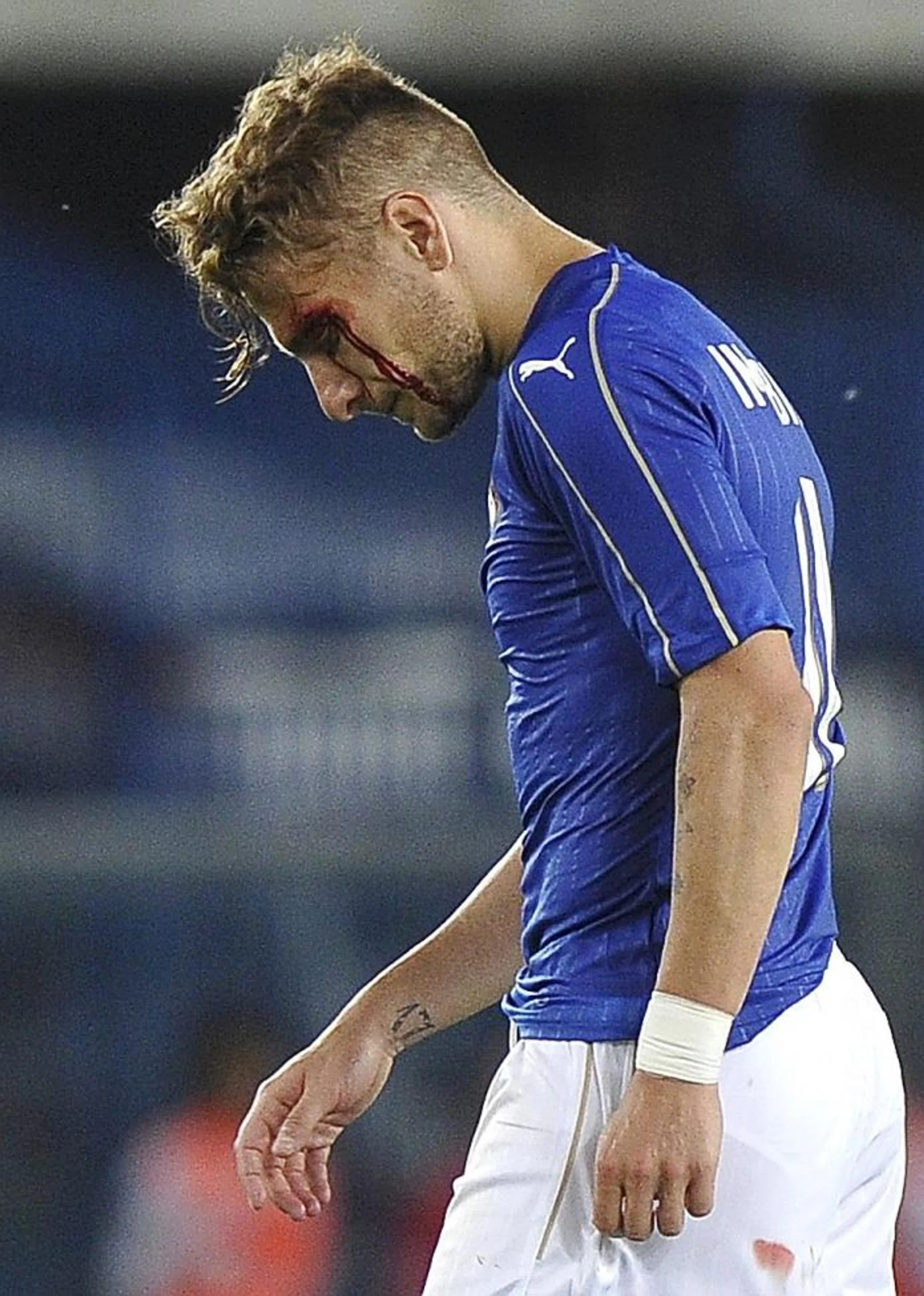WOUNDED: Italy's Ciro Immobile leaving the pitch bleeding.