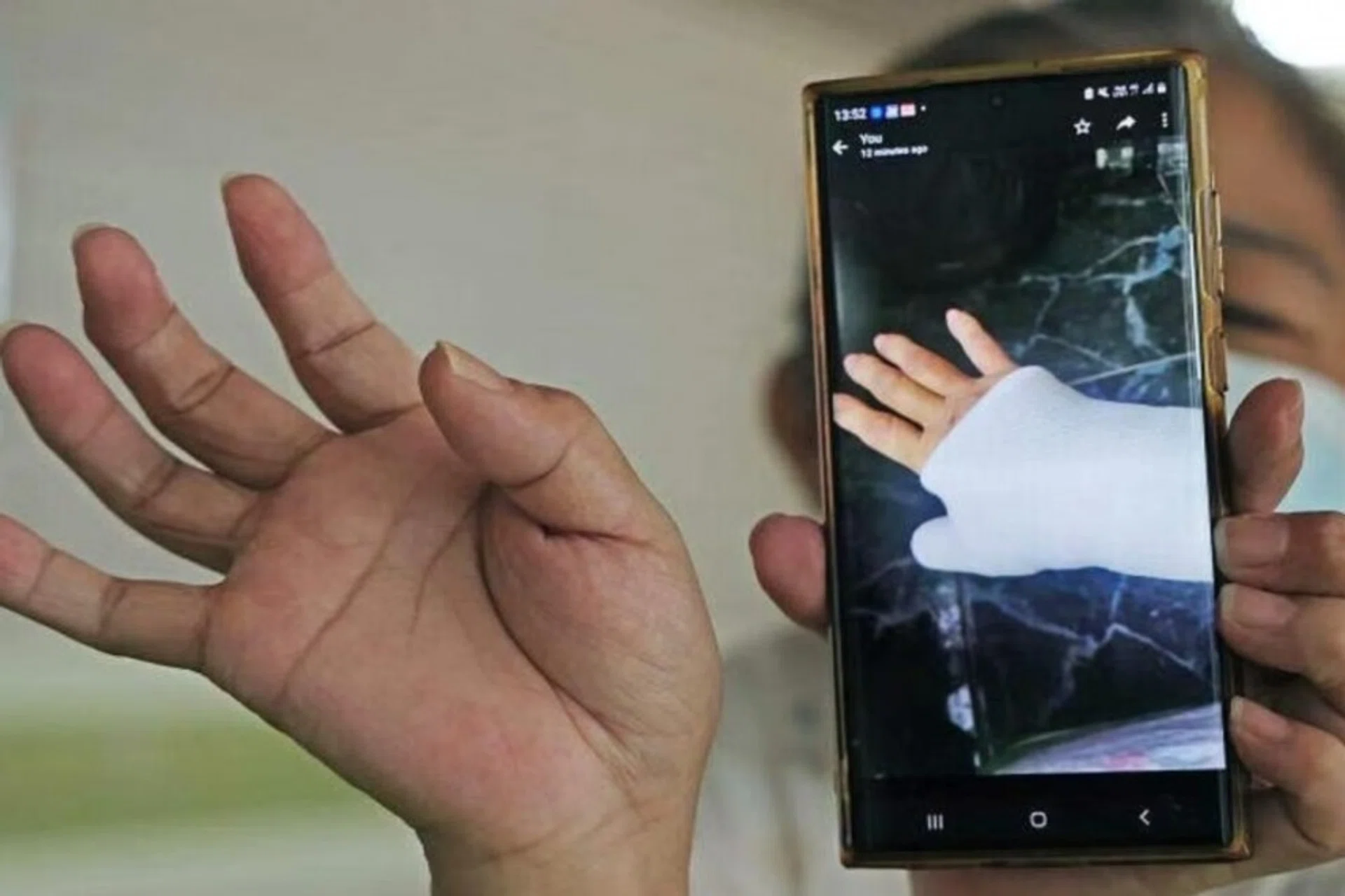 The woman, Ms Liang, said the incident left her with a fractured right palm and she had to wear a cast.
