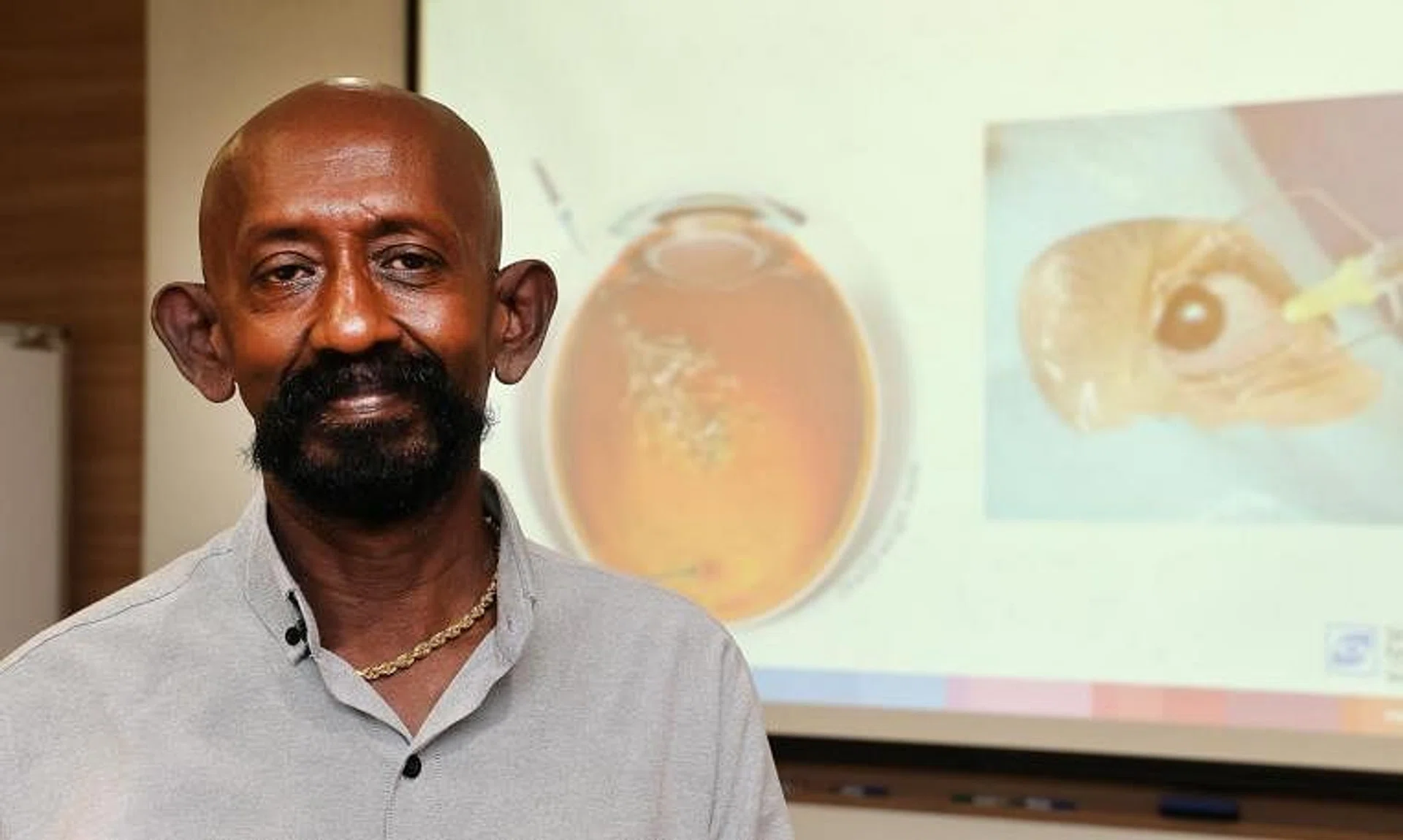 Mr Jaya Pragas regained most of his vision in six months, after receiving the Vabysmo treatment once a month.