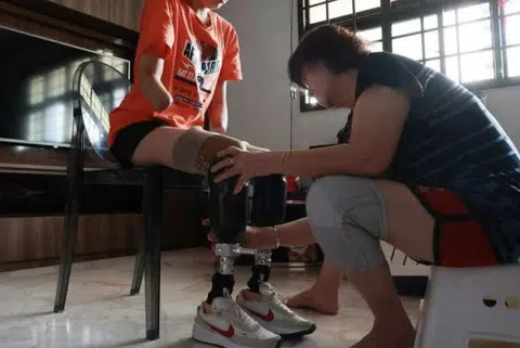 Beautician loses limbs to sepsis