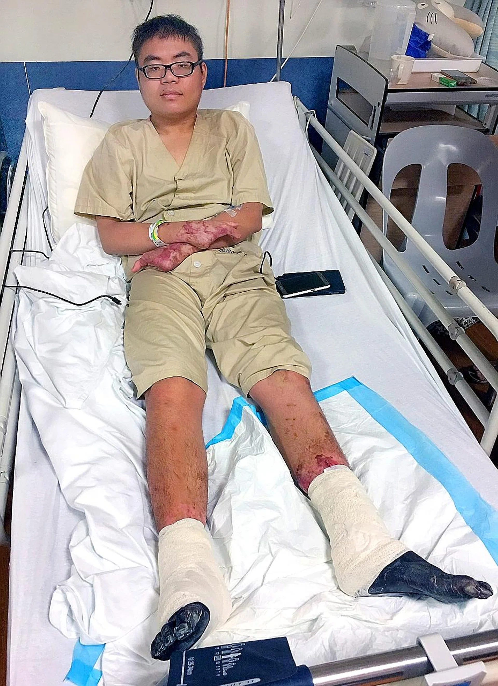 Mr Seah developed dry gangrene, which caused his fingers and toes to turn black. 
