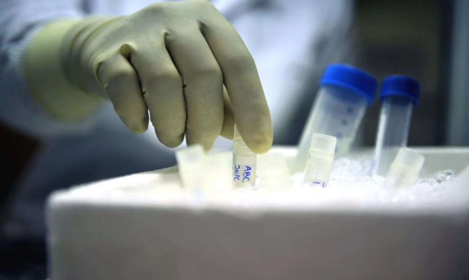 Women aged between 21 and 35 can undergo elective or social egg freezing early next year.