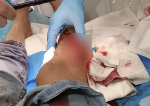 Wild boar attacks woman in Bukit Panjang, bites then drags her onto the road