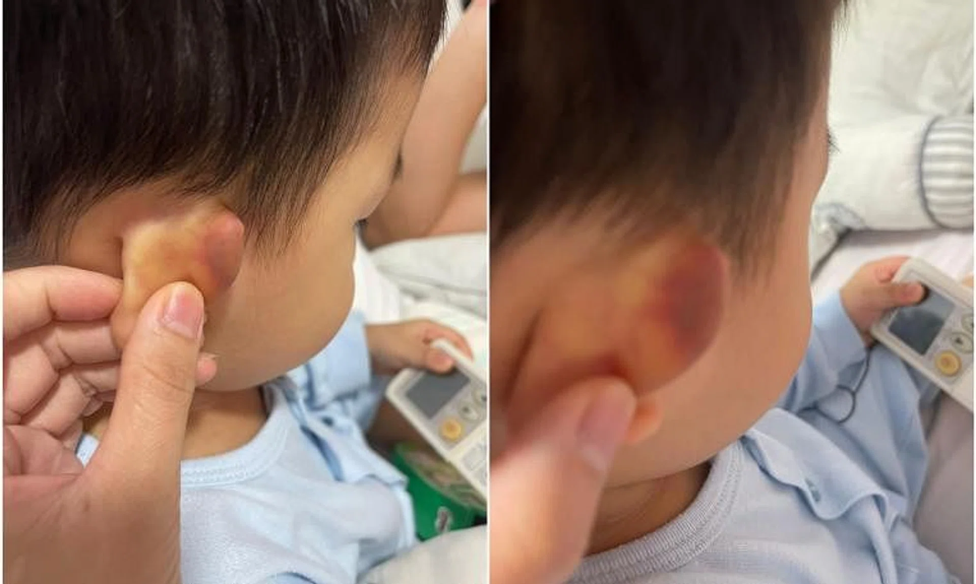 Operations executive Toh Kian Boon discovered a bruise the size of a 50-cent coin on his 22-month-old son's ear after the child's fourth day at school.