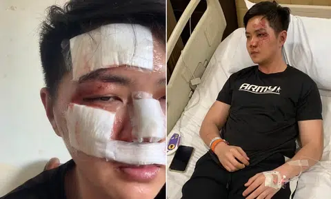 Man claims he was shoved down stairs during night out
