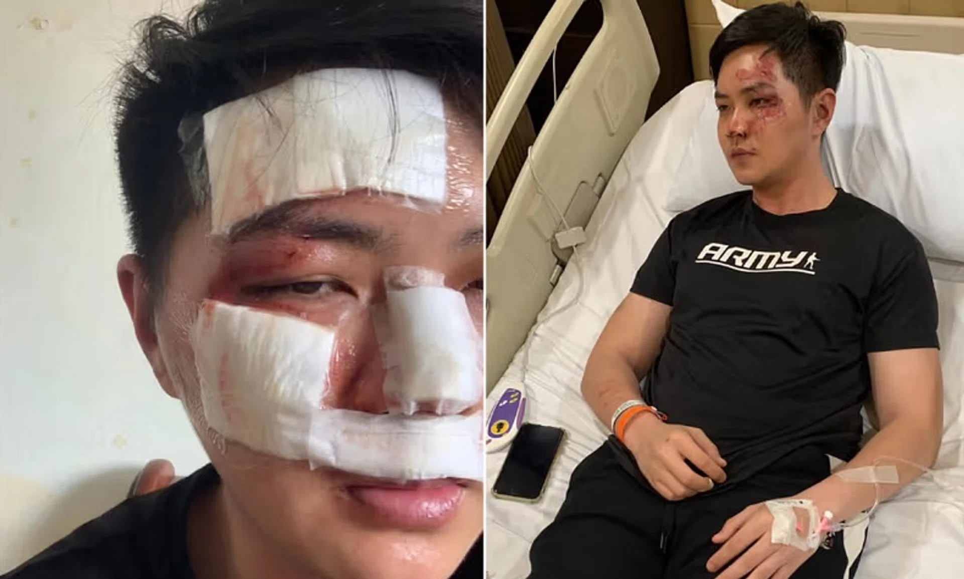Still feeling the effects of the alcohol and suffering from a head injury sustained in the fall, Mr Lun's memories of the incident remain hazy.
