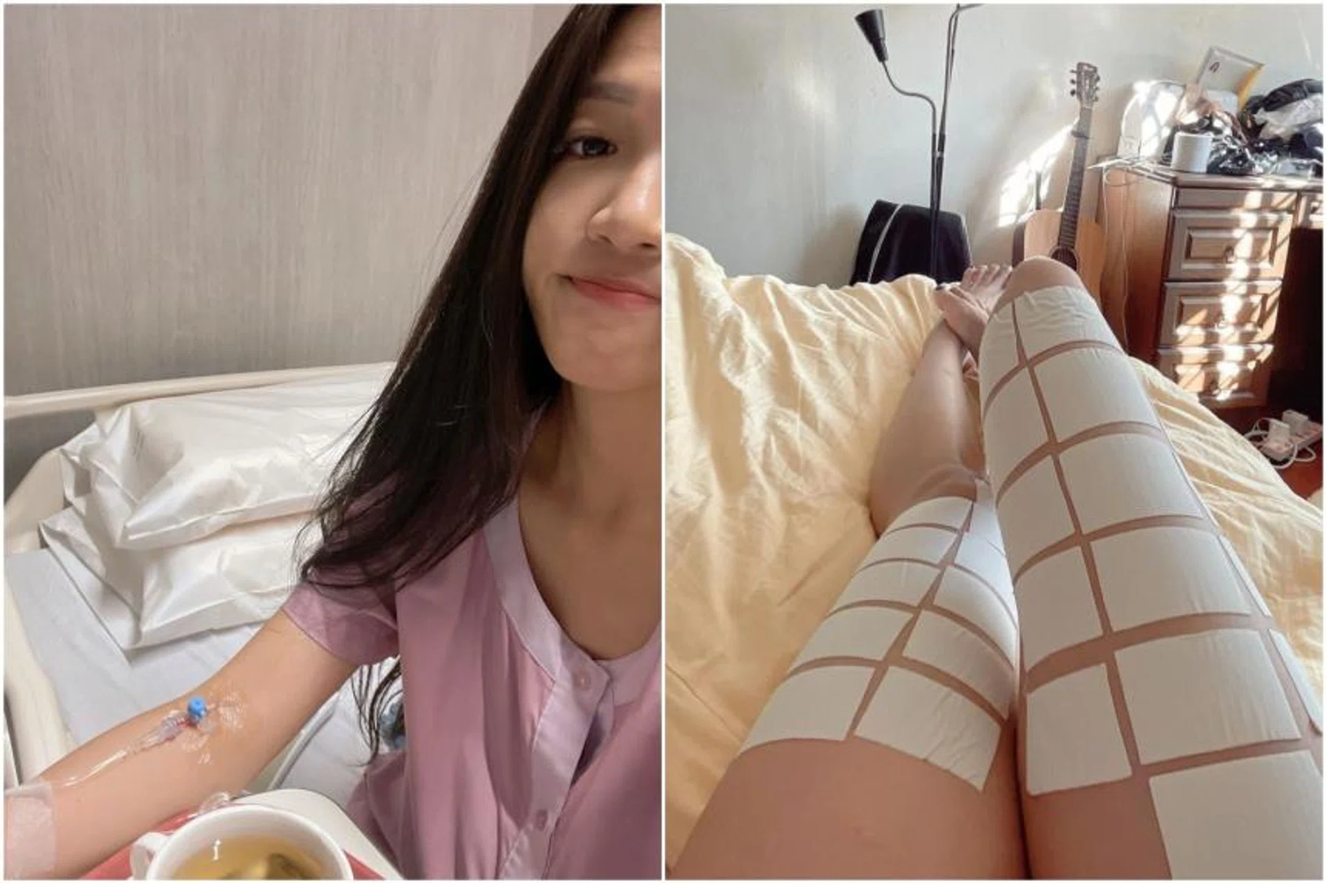 The writer's hospital stay began with a spinning class, which caused her thighs to ache badly. 
