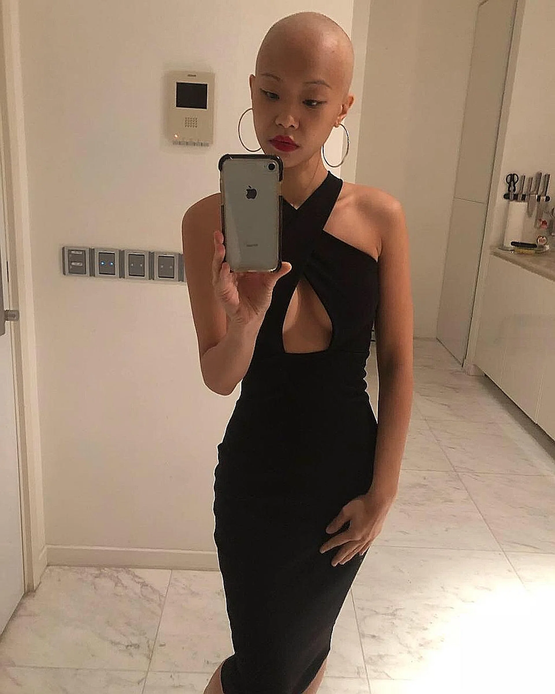 Ms Cindy Wong lost her hair during chemotherapy in 2018.