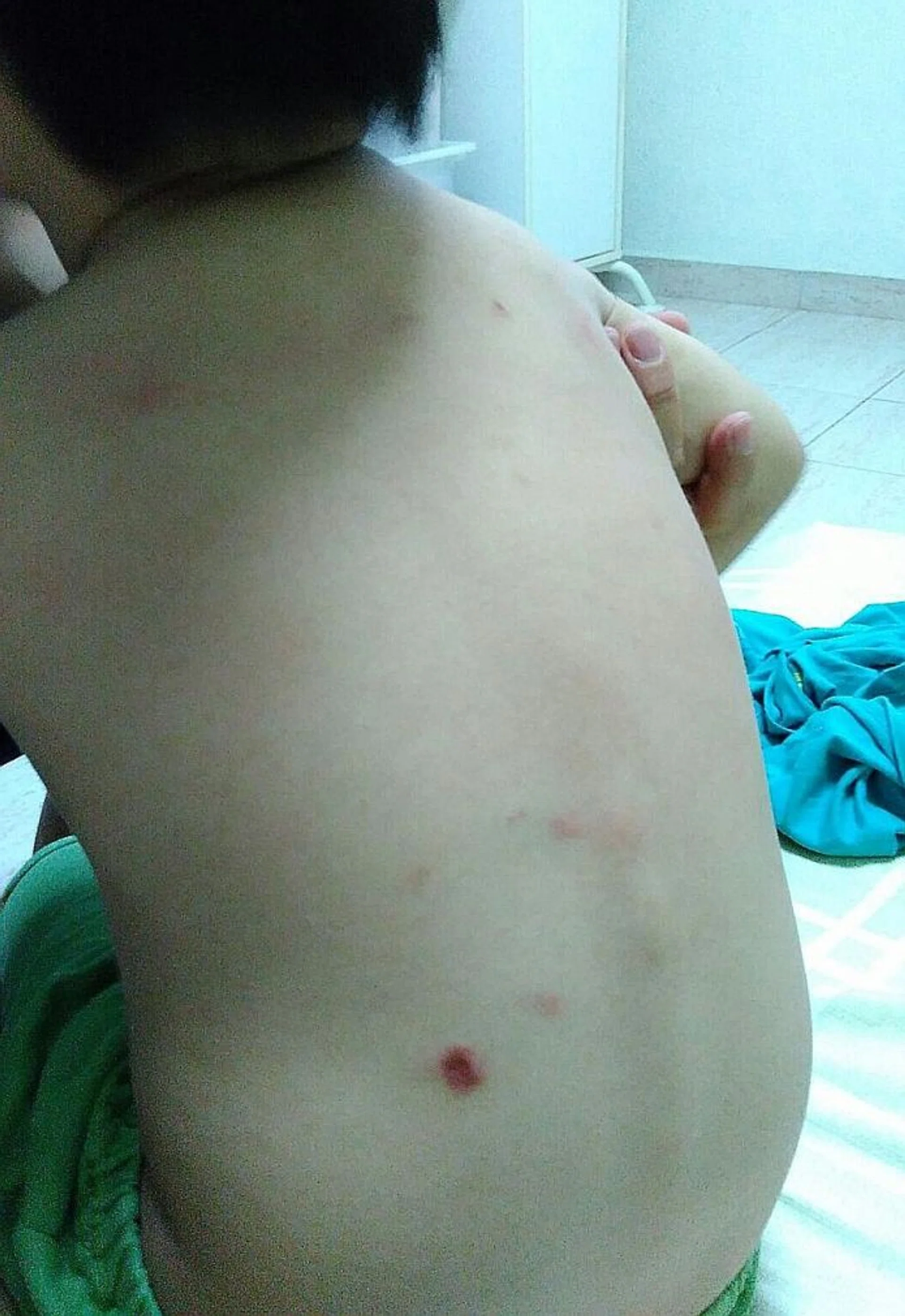 SCARS: Some of the scars and bruises on the boy's body. 