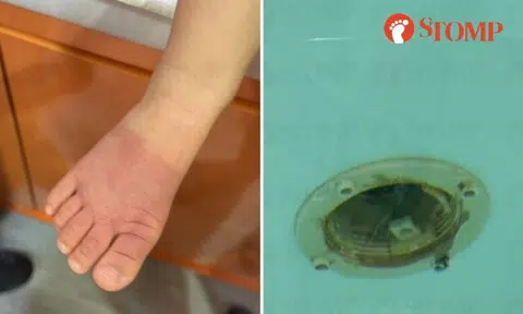 14-month-old girl's foot sucked into hole in BabySpa pool