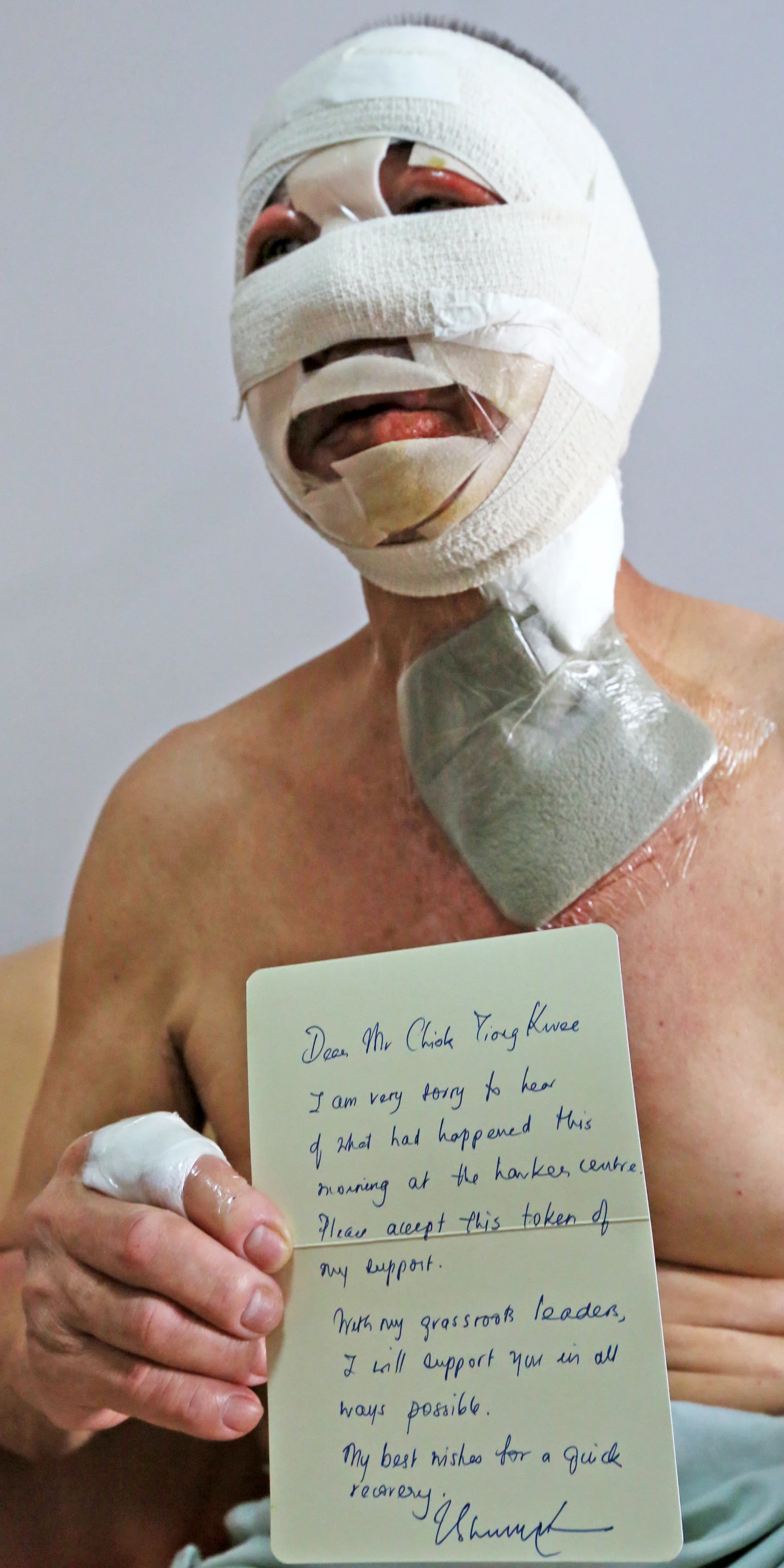 BANDAGED: Mr Chiok Tiong Kwee holding a letter of support from Deputy Prime Minister Tharman Shanmugaratnam.
